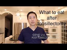 Post Tonsillectomy Diet What To Eat Or Drink After Tonsil Surgery What To Avoid Youtube