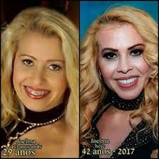 Antes e depois da fama: 160 Ideias De Joelma Calypso Em 2021 Calipso Papel De Parede Animal Print Voce Me Completa