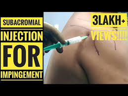 Image result for Subacromial Space Injection