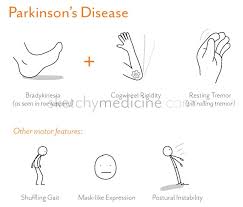 2012 Sketchy Medicine Page 7 Paranoid schizophrenia disorganized schizophrenia catatonic schizophrenia undifferentiated schizophrenia residual schizophrenia schizophrenia spectrum disorders. 2012 sketchy medicine page 7