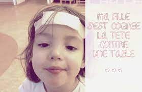 La Jour Où Ma Fille S'est Cognée La Tête Contre Une Table... - Untibebe  Family - Blog Famille, Voyages, Mode Enfant & Lifestyle