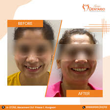 Arushi Goyal (@dr.arushigoyal_dentist) • Instagram photos and videos