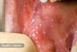 Many viruses can cause a viral rash in addition to other symptoms such as fever and cough. Viral Skin Conditions Pictures Of Rashes Blisters And Sores In Adults And Toddlers