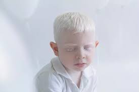Albino Kisilerin Buyuleyen Guzelligini Cektigi Fotograflarla Yakalayan Sanatci Yulia Taits Albinizm Fotograf Sanatcilar
