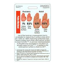 Rule Of 9s Palm Method Burn Chart Vertical Badge