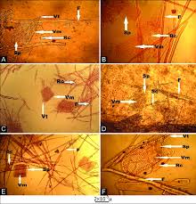Image result for Acacia hockii