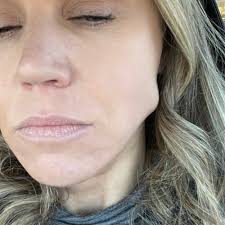 THE BEST 10 ORAL SURGEONS near FORKS TOWNSHIP, PA 18040