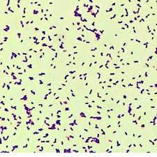 This bacterium, first used as a model to study. Comparison Of Virulence Of Different Listeria Spp In Galleria Model Download Scientific Diagram