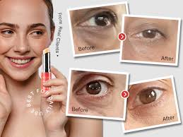 Amazon.com: Retinol Eye Stick, Retinol Eye Cream, Retinol Cream, Retinol  Face Cream, Under Eye Cream Anti Aging, Eye Cream, Brightening Eye Balm  Reduces Fine Lines and Dark Circles, Visible Results in 3-4