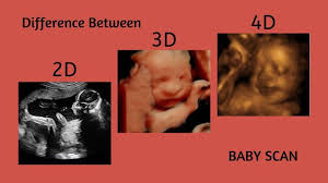 Difference Between 2d 3d And 4d Baby Scan