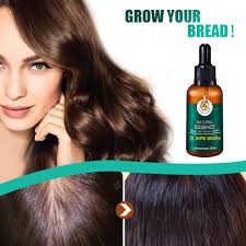 Today's question of the day is: Buy Ginger Germinal Oil Rapid Growth Hair Treatment 7 Day Hair Growth Serum Essence Oil Regrow Ginger Hair Growth Serum Ginger Essential Oil Stop Hair Loss Hair Thinning Treatment Hair Growth Oil For