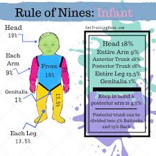 Rule Of Nines For Ems Emt Training Base