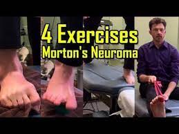 4 Exercises For Mortons Neuroma Exercises To Avoid Surgery How To Heal Mortons Neuroma Quickly Youtube Morton S Neuroma Neuroma Mortons Neuroma Treatment