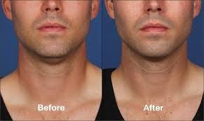 Someone recommended skin care clinics to me for laser hair removal and i have to say the whole experience was excellent. Pin On Sabrina Skin Care