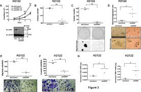 Pixel experience 11 development and porting is a. K Homology Splicing Regulatory Protein Ksrp Promotes Post Transcriptional Destabilization Of Spry4 Transcripts In Non Small Cell Lung Cancer Journal Of Biological Chemistry