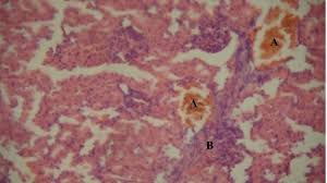 Image result for Alchornea occidentalis