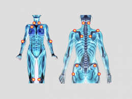 Fibromiyalji Belirtileri