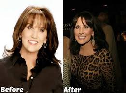 The opening may be on one side, both sides, or in the middle. Robin Mcgraw Plastic Surgery Before After Plastic Surgery Before And After