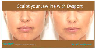 (the above image is courtesy of dermaskin clinics in the uk). Botox For Jaw Pain Plano Tx Bruxism Treatment Frisco Tx
