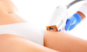 I bought 5 sessions for laser hair removal for underarms. Laser Hair Removal Sessions Vixen Spa Yonge And Eglinton Groupon