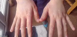 Image result for pictures of children with cold hands
