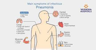 Check spelling or type a new query. Pneumonia Types Causes Symptoms Diagnosis And Treatment