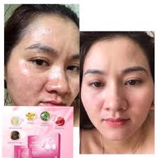 Bena Collagen Gana