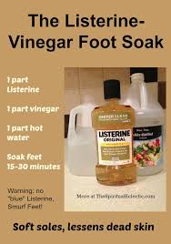 1/4 cup listerine 1/4 cup vinegar 1/2 cup warm water. Listerine Vinegar Foot Soak Really Works