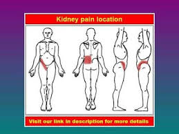 Pin On If Damage Kidney Symptoms