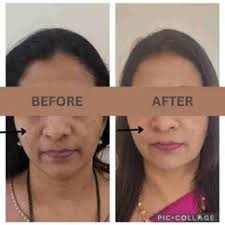 The Skin Doctors: Best Dermatologist in Pimple Saudagar, Pune