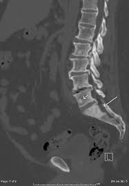 The american cancer society provides detailed information on prostate cancer and its treatment. Webpathology Com A Collection Of Surgical Pathology Images