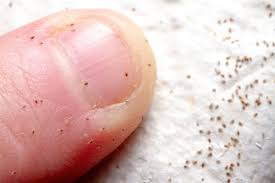 Image result for mite bites on humans