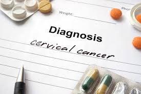 There are four stages of cervical cancer: 5 Cervical Cancer Myths Md Anderson Cancer Center
