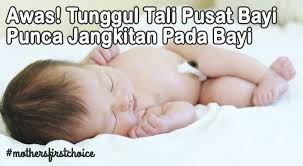 Tali, rope, trail, center, library, center x, center z, center y, pambaram. Awas Tunggul Tali Pusat Bayi Punca Mothers First Choice Facebook