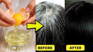 Onion juice is interesting for how it offers a strong scent, but it is more than just something your nose it allows blood to move well enough to allow the follicles to feel naturally restored. Only 2 Minutes White Hair Turn Black Naturally White Hair Treatment Diy Remedies Youtube