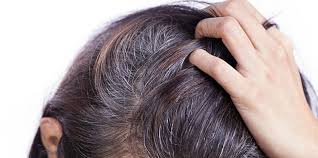 Unless you have a certain 'grey hair' gene that runs in the family, you should not be seeing. Why Does Hair Turn Gray The Causes Of Premature Grays Shape