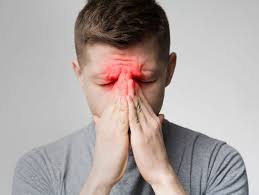 Image result for Acute Localized Headache