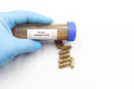 Image result for Fecal Transfer