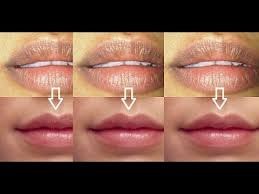 21 cara menipiskan bibir tebal secara alami yang ampuh!by cantika perawatan bibir. Beginilah Mengatasi Bibir Hitam Secara Alami Koranindonesia Id