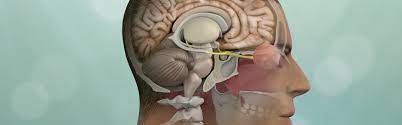 Minimally Invasive Brain Surgery | Keyhole Craniotomy | Pacific Brain Tumor  Center