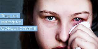 Tips To Prevent Conjunctivitis (Pink Eye) - Kdah Blog