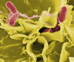 Salmonella bacteria typically live in animal and human intestines and are shed through feces. Salmonellosis Wikipedia