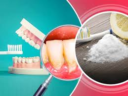 Effective methods for removing dental plaque at home. How To Get Rid Of Dental Plaque At Home Naturally Lifealth