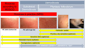 Image result for demodex rosacea