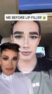 While working as a local makeup artist in his hometown of bethlehem, new york. Lip Filler Saved My Life Tbh Lol