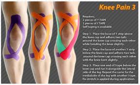 Pin On Kinesiology Tape Ares