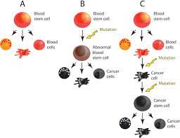 Some people do experience a change in bowel habits that a suspected arsonist was on the loose sunday morning after igniting a brush fire in the pacific palisades area of los angeles county that has spread. Blood Cancer Cell An Overview Sciencedirect Topics
