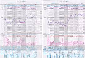 Charting Basics Understanding Your Cycle Pretty Neat Living