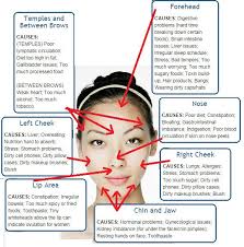 Pin By Kathy Wawra On Skincare Methods Face Mapping Acne Pimples On Face Face Acne