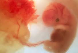 Svangerskapet deles utviklingsmessig inn i tre trimestre. Fetal Development Stages Month By Month Embryo Pictures